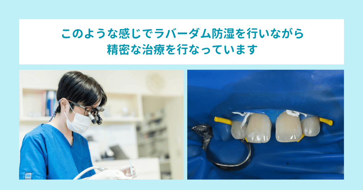 ラバーダム防湿を行いながら拡大鏡で精密に治療している様子